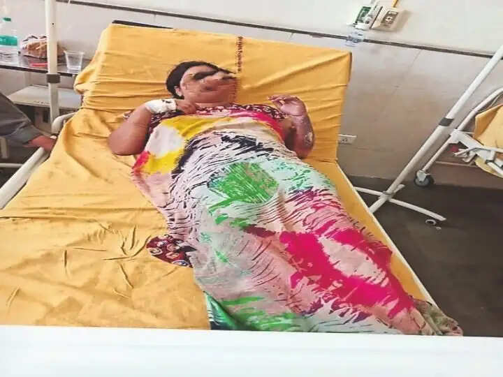 प्रेमिका के लिए पति ने पत्नि को जिंदा जलाया, महिला की जान बची, आरोप लगाया- एक साल पहले पंचायत में मांगी थी माफी, नहीं सुधरे