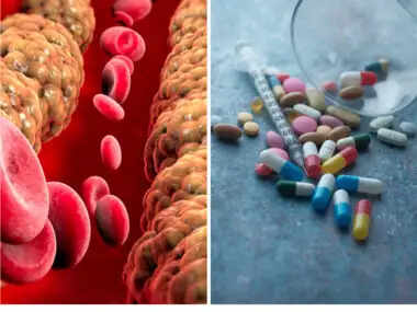 क्या है lipid profile test ? जो बचा सकता है आपको दिल की बीमारियों से