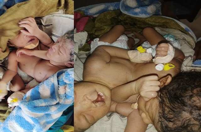 HARYANA:-  48 घटे के बाद जिंदगी की जग से हार गई एक दिल के साथ जुड़ी हुई दो बच्चियां