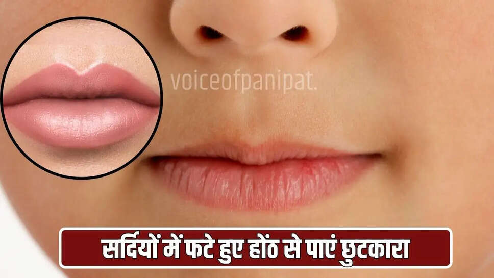 ड्राई होंठों में नमी बनाए रखने के लिए आमतौर पर लिप बाम का प्रयोग किया जाता है, लेकिन यह पर्याप्त नहीं होता। ऐसे में होंठों पर पपड़ी जमने लगती है और फिर होंठ फट जाते हैं।